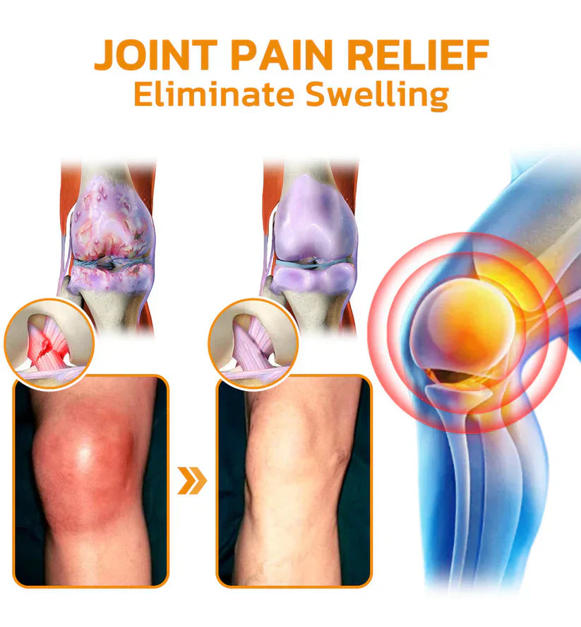 👏✅Official Store: flysmus™ Bee-Venom Pain-Relief Bone Healing Cream