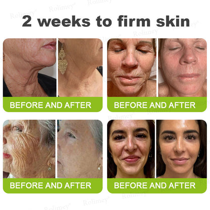 🔥Made and shipped from the UK🧑‍⚕️💫Rolimey® Botox & Vita-A Retinol Shot Wrinkle-Lift Tightening cream - Last Day Promotion 70% OFF