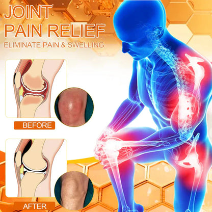 🏆✅Official Store: flysmus™ Bee-Venom Pain-Relief Bone Healing Cream