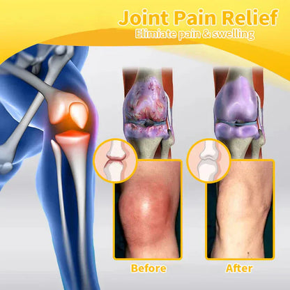 🏆✅Official Store: flysmus™ Bee-Venom Pain-Relief Bone Healing Cream