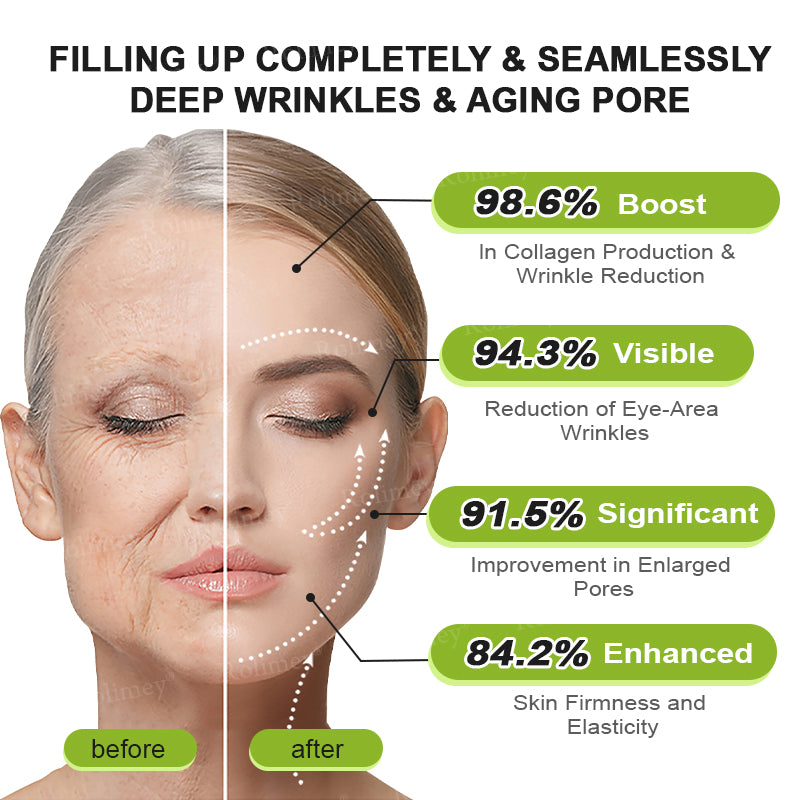 🔥Made and shipped from the UK🧑‍⚕️💫Rolimey® Botox & Vita-A Retinol Shot Wrinkle-Lift Tightening cream - Last Day Promotion 70% OFF