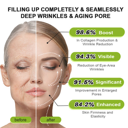 🔥Made and shipped from the UK🧑‍⚕️💫Rolimey® Botox & Vita-A Retinol Shot Wrinkle-Lift Tightening cream - Last Day Promotion 70% OFF