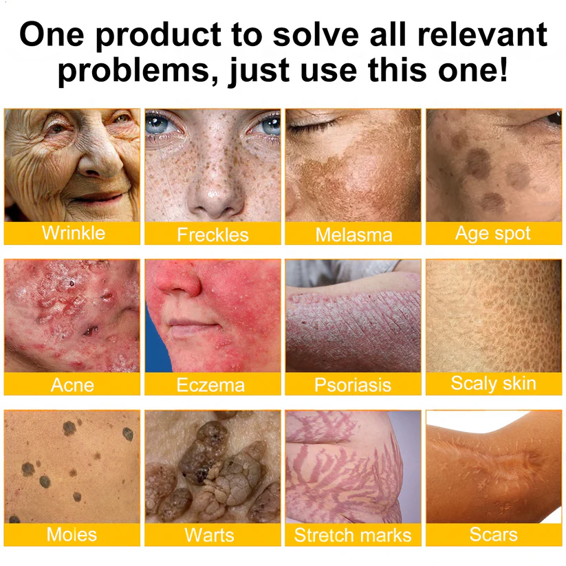 🔥Pheromex® Bee Venom Skin Restoration Cream — 🔥Limited Time 80% OFF🔥