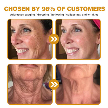 🔥Pheromex® Bee Venom Skin Restoration Cream — 🔥Limited Time 80% OFF🔥