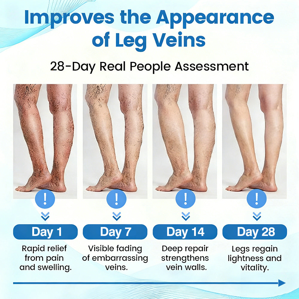 🇬🇧🔥GFOUK® VEINRX Healing Spray (Designed for Varicose veins, Spider veins, Deep vein Thrombosis, Chronic venous insufficiency, Venous ulcers, Thrombophlebitis and other venous issues)
