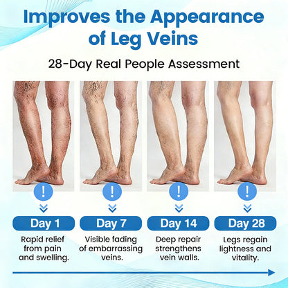 🇬🇧🔥GFOUK® VEINRX Healing Spray (Designed for Varicose veins, Spider veins, Deep vein Thrombosis, Chronic venous insufficiency, Venous ulcers, Thrombophlebitis and other venous issues)