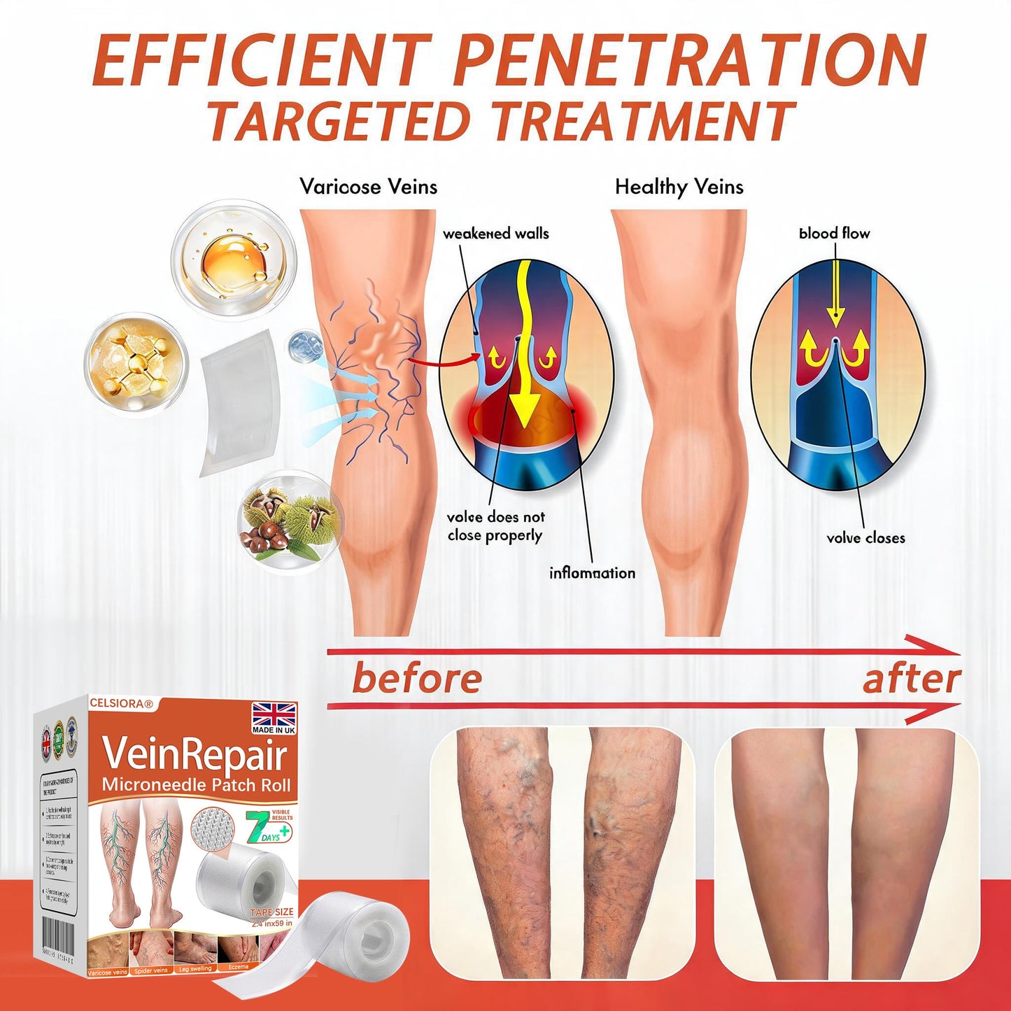 🧑‍⚕️🔥Celsiora® Vein Ease Microneedle Care Patch(For Spider Veins, Varicose Veins, Swelling & Leg Fatigue) - Last Day Promotion 50% OFF