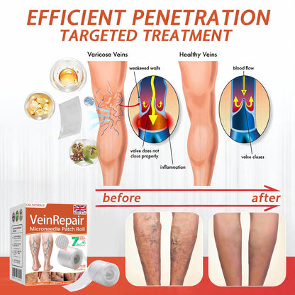 🧑‍⚕️🔥Celsiora® Vein Ease Microneedle Care Patch(For Spider Veins, Varicose Veins, Swelling & Leg Fatigue) - Last Day Promotion 50% OFF