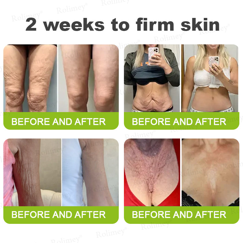 🔥Made and shipped from the UK🧑‍⚕️💫Rolimey® Botox & Vita-A Retinol Shot Wrinkle-Lift Tightening cream - Last Day Promotion 70% OFF