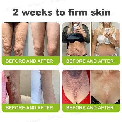🔥Made and shipped from the UK🧑‍⚕️💫Rolimey® Botox & Vita-A Retinol Shot Wrinkle-Lift Tightening cream - Last Day Promotion 70% OFF