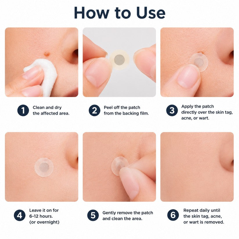 ✨GFOUK® 2-in-1 Microneedle & Hydrocolloid Patch🍀 | Removes raised moles, acne, flat warts, and skin tags | Invisible patches for face and body