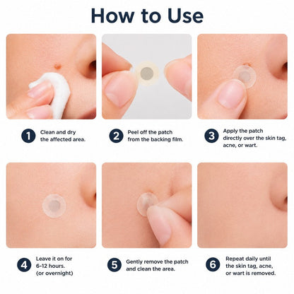 ✨GFOUK® 2-in-1 Microneedle & Hydrocolloid Patch🍀 | Removes raised moles, acne, flat warts, and skin tags | Invisible patches for face and body