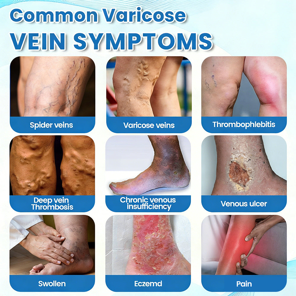 🇬🇧🔥GFOUK® VEINRX Healing Spray (Designed for Varicose veins, Spider veins, Deep vein Thrombosis, Chronic venous insufficiency, Venous ulcers, Thrombophlebitis and other venous issues)