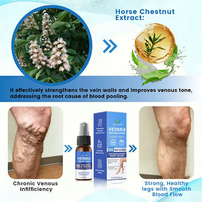 🇬🇧🔥GFOUK® VEINRX Healing Spray (Designed for Varicose veins, Spider veins, Deep vein Thrombosis, Chronic venous insufficiency, Venous ulcers, Thrombophlebitis and other venous issues)