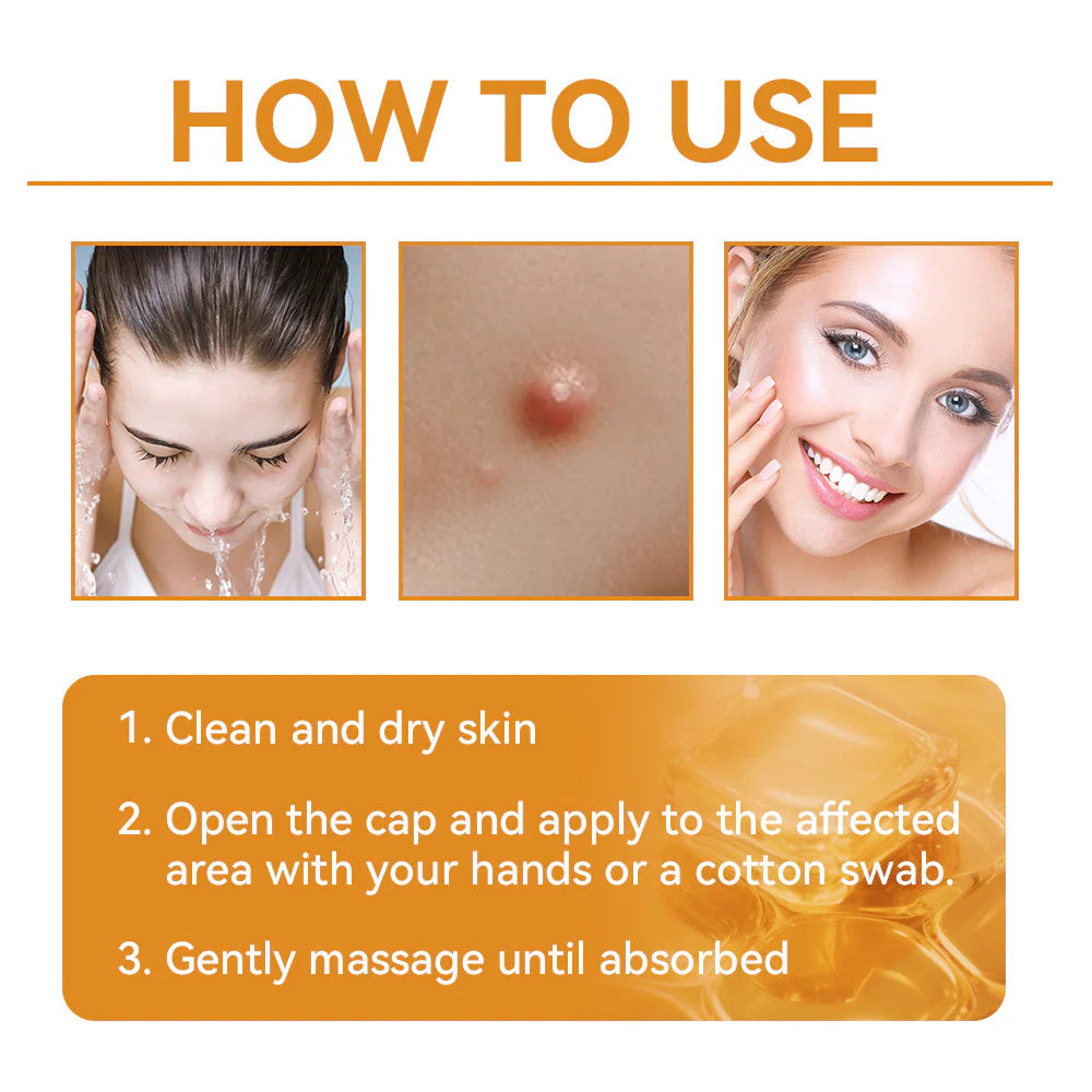 🔥Pheromex® Bee Venom Skin Restoration Cream — 🔥Limited Time 80% OFF🔥