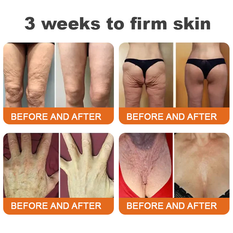 ✨Rolimey® Botox Bee Venom Firming Serum Stick(🔥LAST DAY 70% OFF)✨✨
