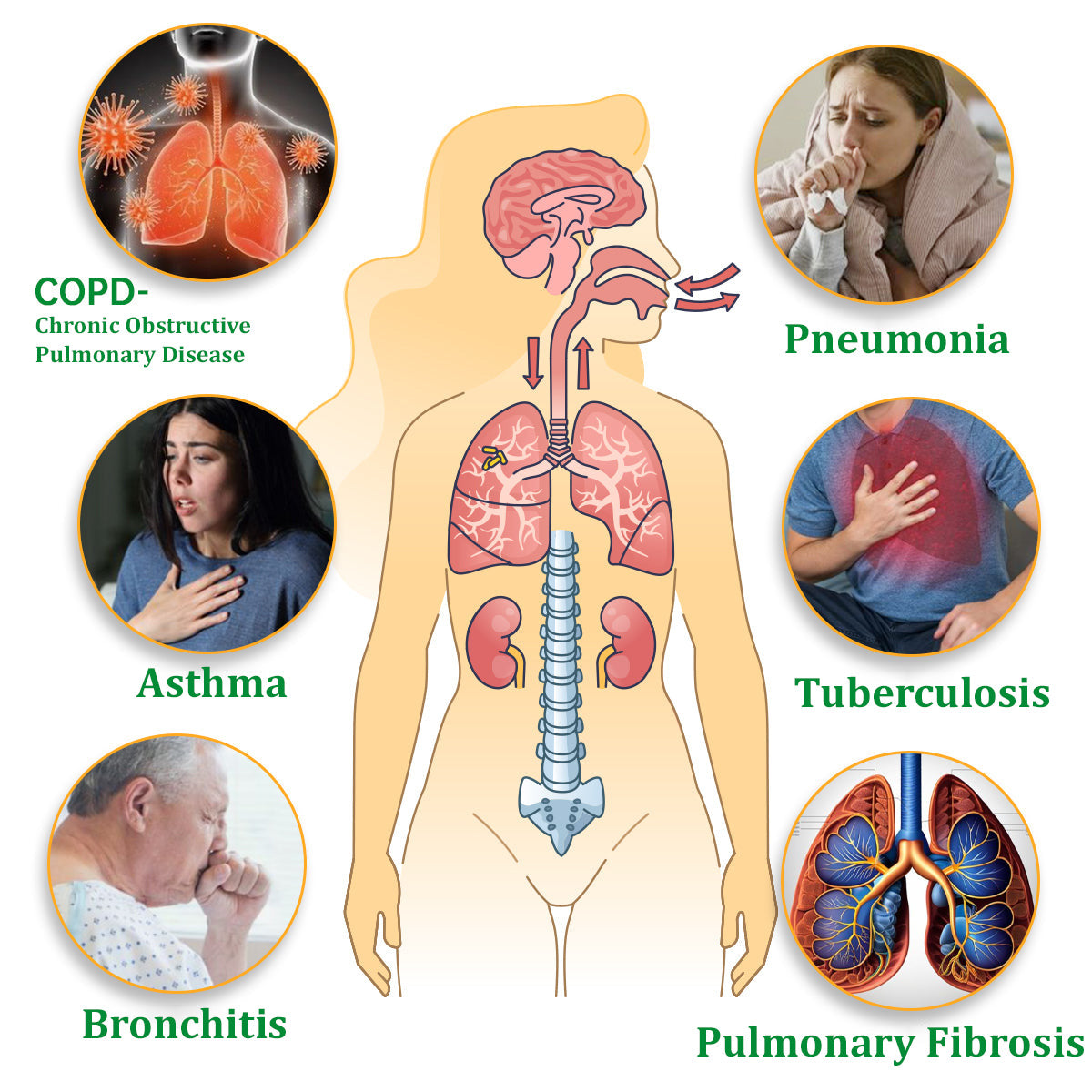 💯✅Official Store:Ourlyard™ Herbal Lung Cleansing Inhaler 🫁MHRA Approved(💝 Cough, wheezing, shortness of breath, sputum, stuffy nose, bronchitis, bronchitis, allergy symptoms, lung discomfort💝)