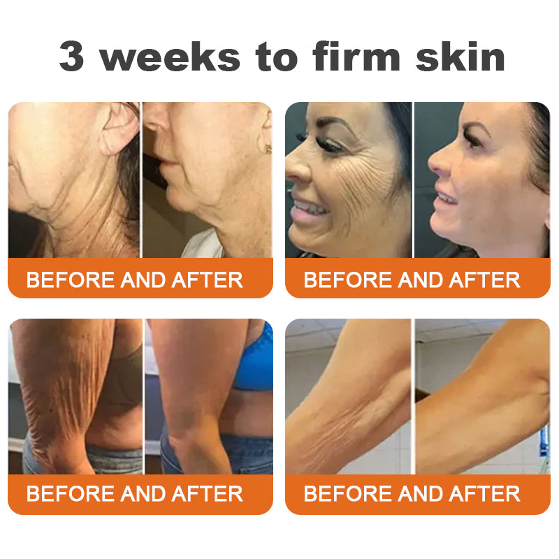 ✨Rolimey® Botox Bee Venom Firming Serum Stick(🔥LAST DAY 70% OFF)✨✨
