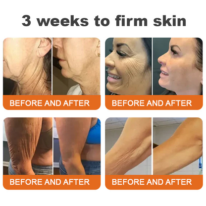 ✨Rolimey® Botox Bee Venom Firming Serum Stick(🔥LAST DAY 70% OFF)✨✨