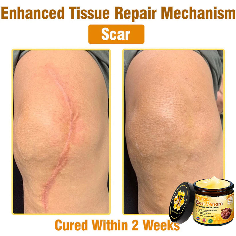 🔥Pheromex® Bee Venom Skin Restoration Cream — 🔥Limited Time 80% OFF🔥