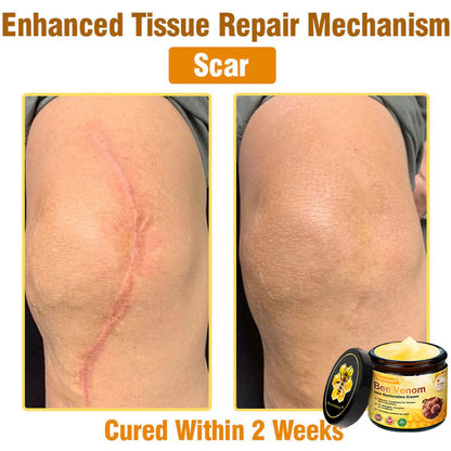 🔥Pheromex® Bee Venom Skin Restoration Cream — 🔥Limited Time 80% OFF🔥