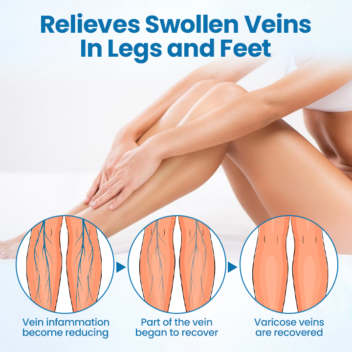 🔥Ourlyard® VeinGuard Herbal Spray-✅ Clinically proven to eliminate varicose veins in just 7 days! (🔥Limited Time 80% OFF🔥)