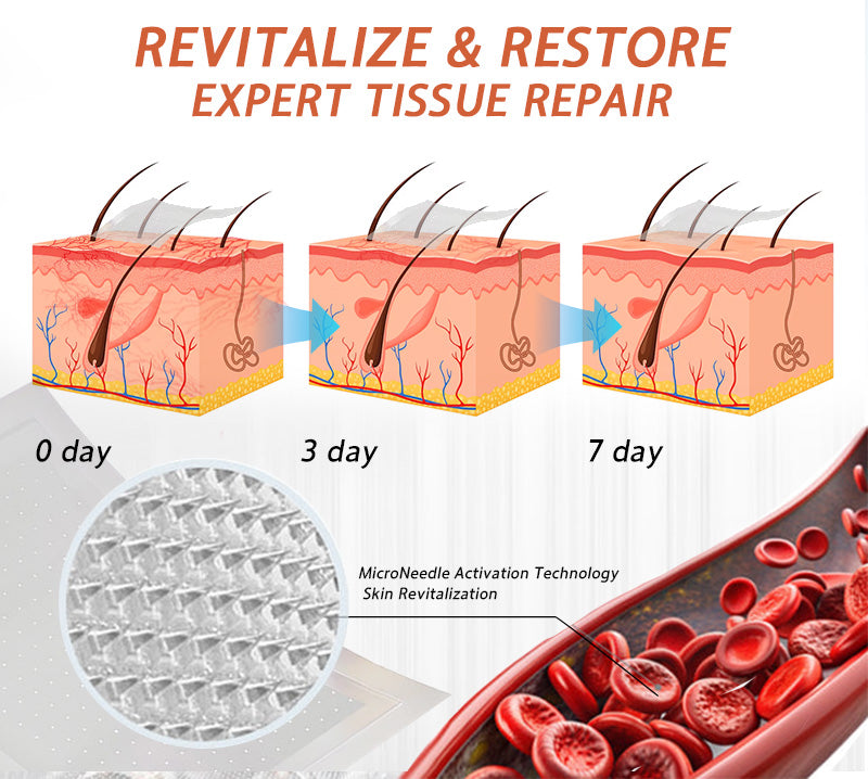 🧑‍⚕️🔥Celsiora® Vein Ease Microneedle Care Patch(For Spider Veins, Varicose Veins, Swelling & Leg Fatigue) - Last Day Promotion 50% OFF