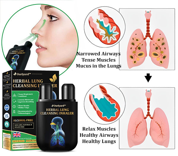 💯✅Official Store:Ourlyard™ Herbal Lung Cleansing Inhaler 🫁MHRA Approved(💝 Cough, wheezing, shortness of breath, sputum, stuffy nose, bronchitis, bronchitis, allergy symptoms, lung discomfort💝)